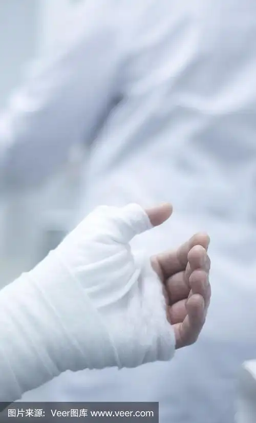 骨折后,医生在患者前臂和手腕上使用石膏石膏和绷带固定.