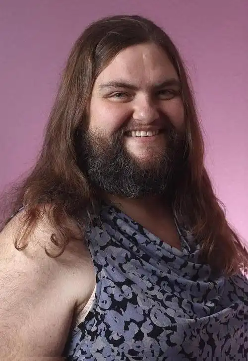 39岁女子患怪病,脸上长满络腮胡,还长有胸毛,如同一个壮汉