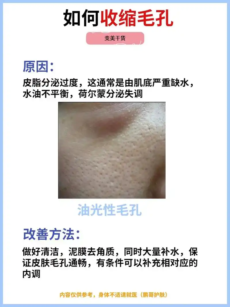 出油,毛孔粗大怎么办?一起逆袭变美99.很多姐妹对毛孔都束手 - 抖音