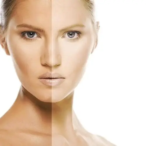 【爱仕兰无针水光】美白祛黄亮肤