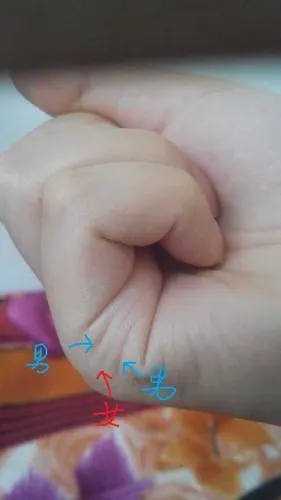 有一些横向的纹路,就是我们今天要说的"子女线" 子女线多条,有深有浅