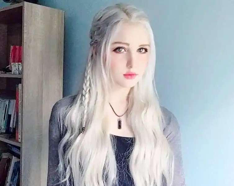 俄罗斯女孩天生银发酷似精灵