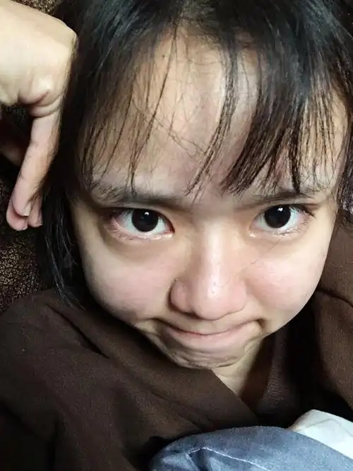 有没有刘海,都一样丑.我的发际线无法拯救