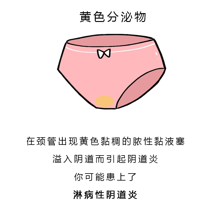 女生的内裤到底有多脏