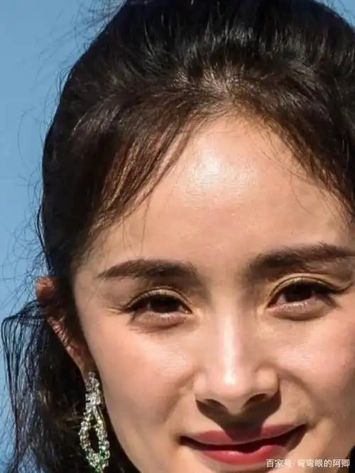 杨幂都摆脱不了——眼皮老化