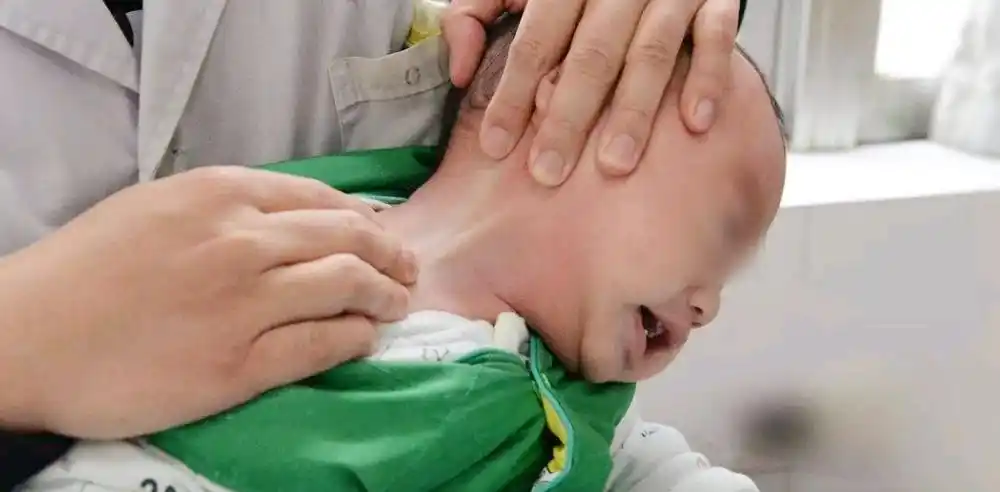 宝宝"歪头杀"看你,虽然看起来很萌,其实可能是病,家长别大意