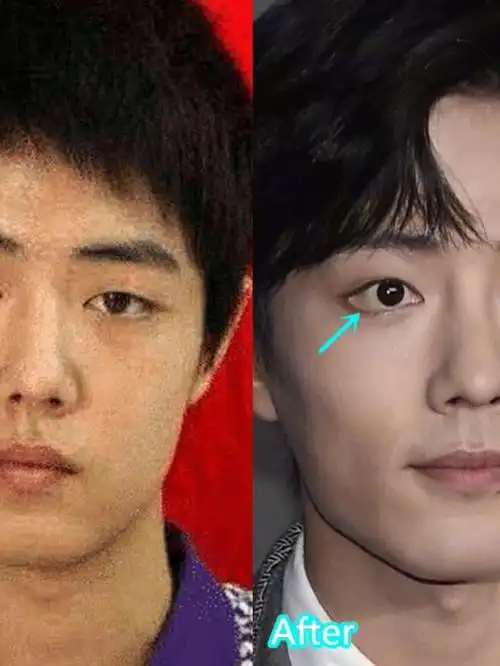 提到肖战想必大家都不陌生吧,如今娱乐圈当红的明星,_圈子-新氧美容