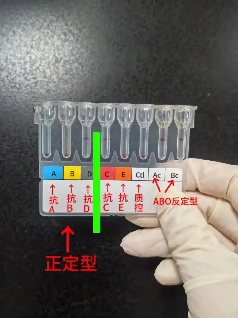 今天学习abo血型鉴定(微柱凝胶法)99首先要知道检验原理: - 抖音