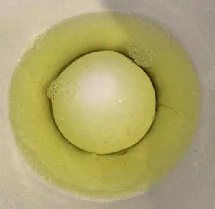 尿液这个色(shai),还有得救么?