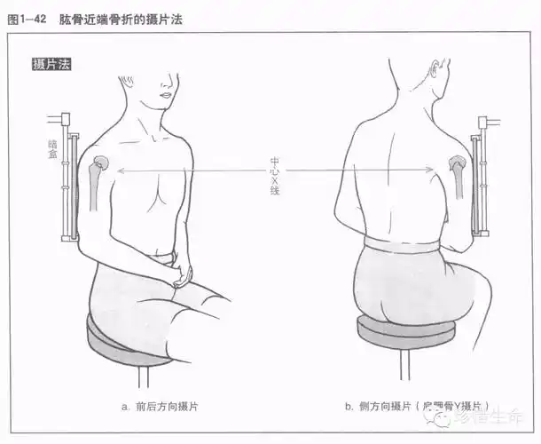 肩关节x线检查体位大全