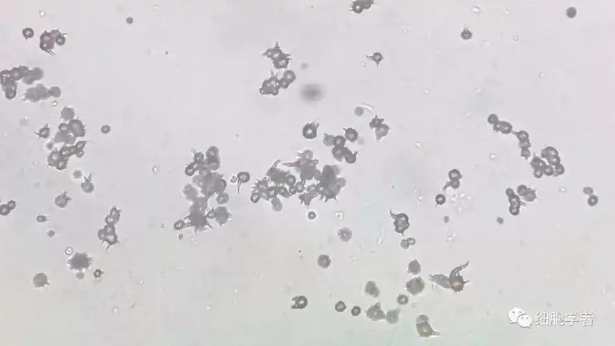 尿酸结晶的形态