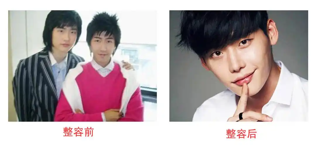 李钟硕整容前后照片对比 帅哥都是整出来的啊