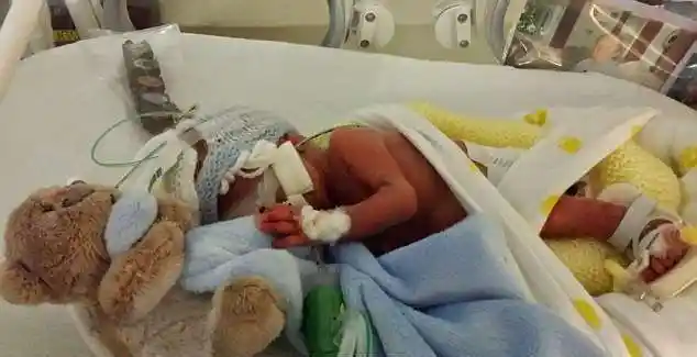 夫妻每天坚持为6个月的早产儿拍照, 2个月后迎来振奋消息!