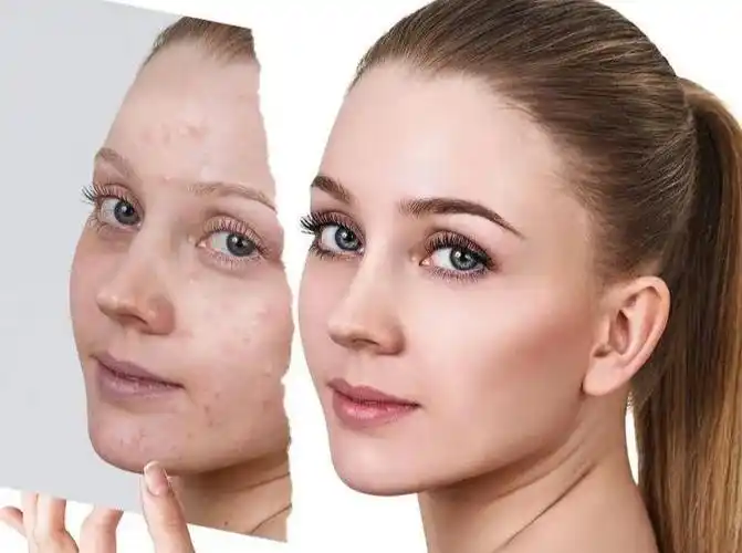 如何修复敏感肌肤?苗莲花效果如何?_皮肤