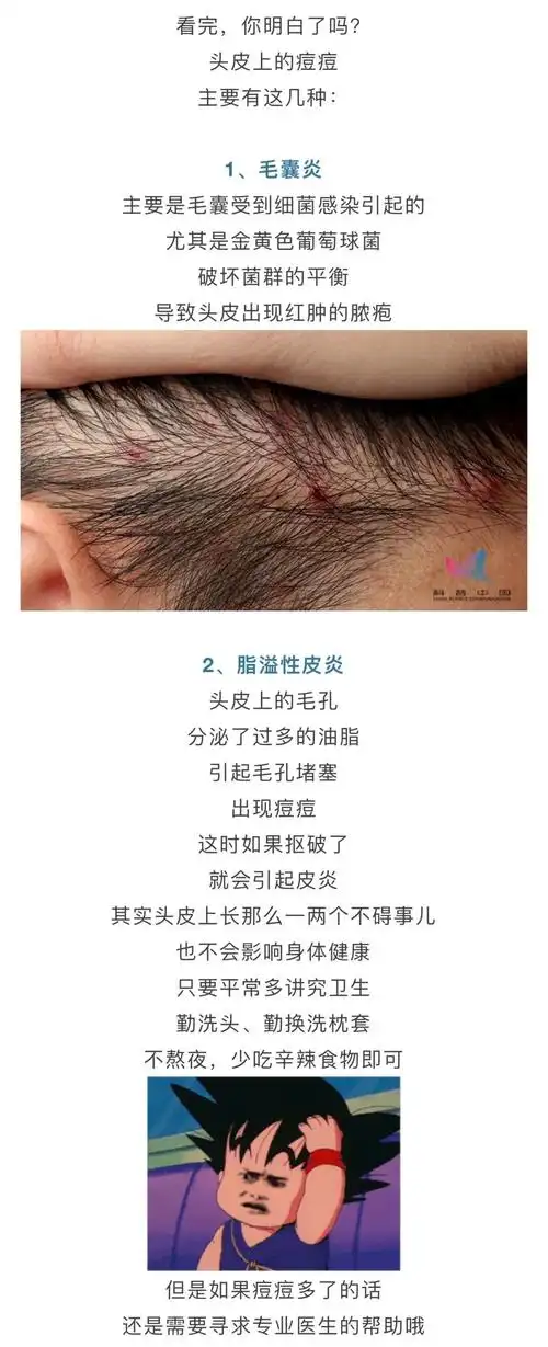 头皮上长得"小疙瘩"到底是啥?该如何预防?答案全在这