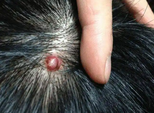 医生暗示:3种病需要考虑_头发_相关_毛囊