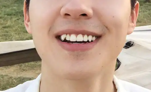 4位男艺人的虎牙只有一张是王俊凯的真爱粉的你能几秒找到呢