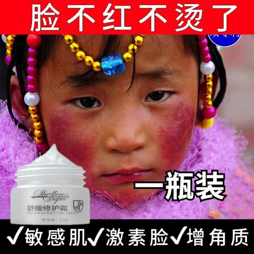 防冻面霜修复儿童婴儿高原红过敏角质层敏感宝宝肌肤红脸蛋 1瓶装
