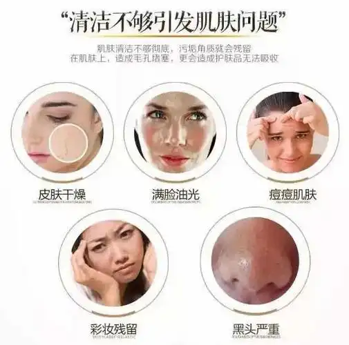 深层清洁没做好,各类皮肤问题都会找上你,比如毛孔堵塞,黑头