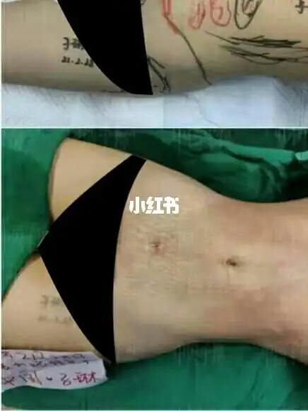 威塑腰腹部环吸给你不一样的享瘦体验73