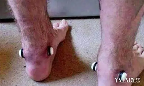 泰国新时尚钻脚筋 比酷刑还惨烈真的怕了|泰国|新时尚-社会资讯-川北