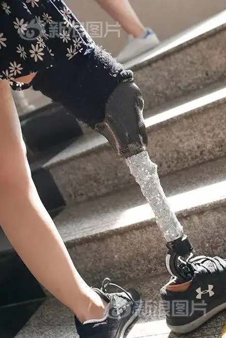 周末故事自信女孩卸下伪装露出假肢没有腿照样可以穿短裤