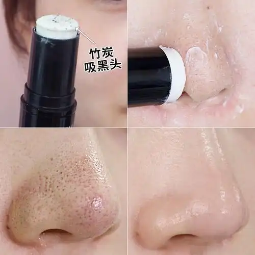 韩国进口去黑头清洁磨砂棒导出液草莓鼻子修复取粉刺神器一抹净