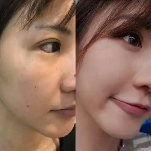 脸上多年斑点怎么去除?祛斑口碑最好十大排名