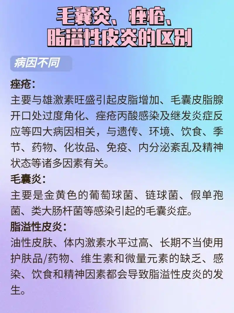 毛囊皮脂腺开口处过度角化,痤疮丙酸感染及继发炎症反应等四大病因