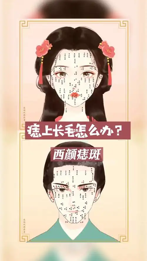 你的痣上长毛啦吗