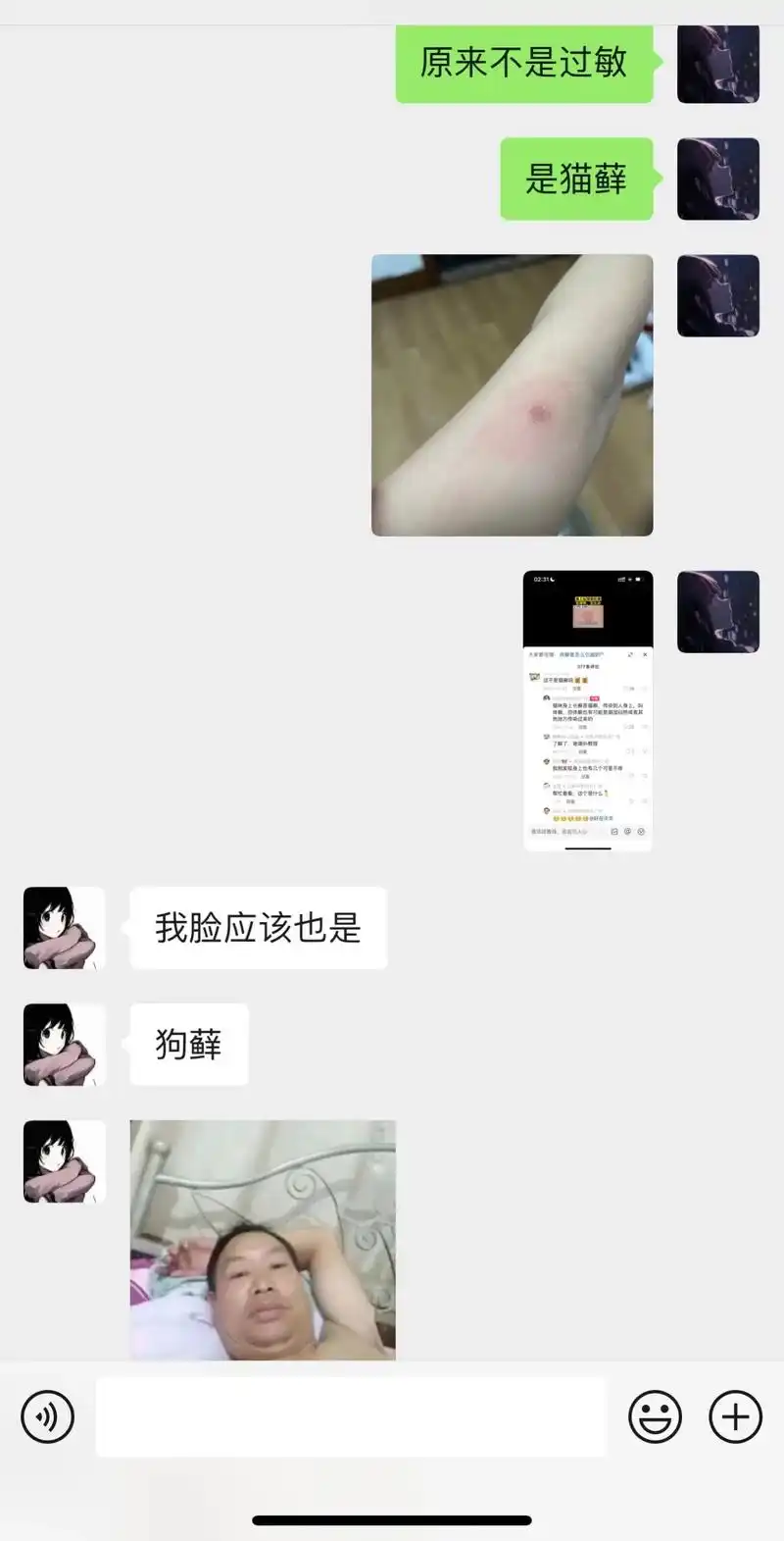 #互相伤害 原来脸上四处,眼睛两处是往常没休息好的过敏性皮炎 - 抖音