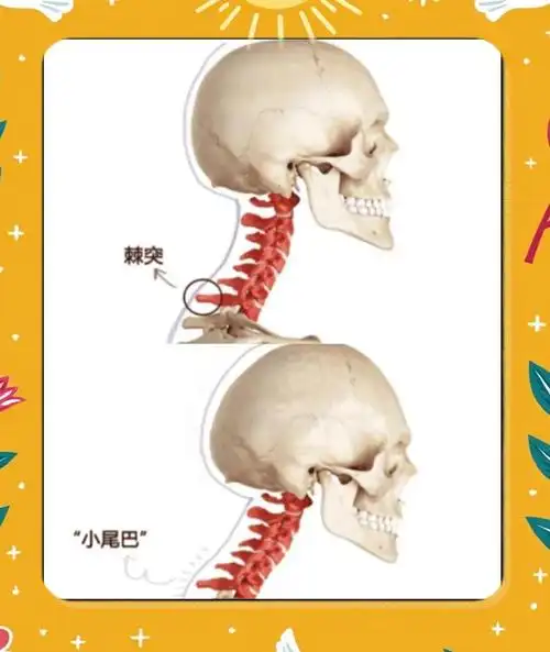 金华正骨馆:富贵包和脖子前倾的福音