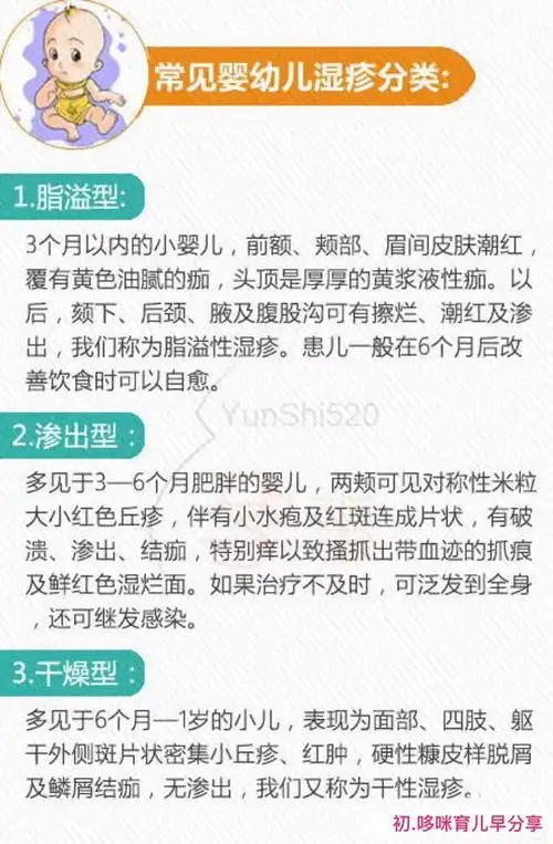治疗婴儿湿疹的偏方_治疗肛周湿疹的偏方_治疗肛周湿疹偏方大全