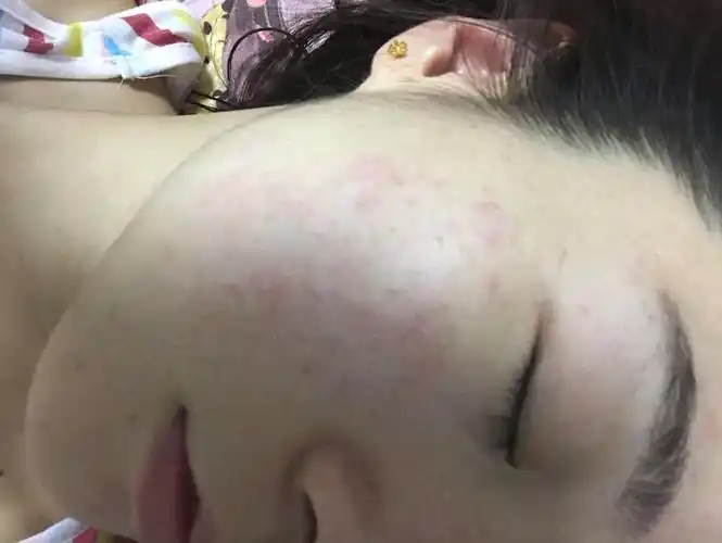 很痒,不舒服,不知道是过敏还是 一个星期没用化妆品了,今天突然脸上