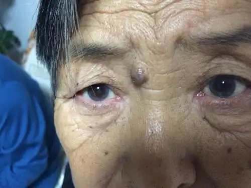 老年人总是眼干眼涩是什么问题,上的眼药也不好用