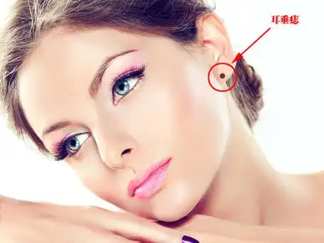 耳垂痣若女人耳垂长得大而饱满,再加上长有一颗颜色光鲜的黑痣,则被称