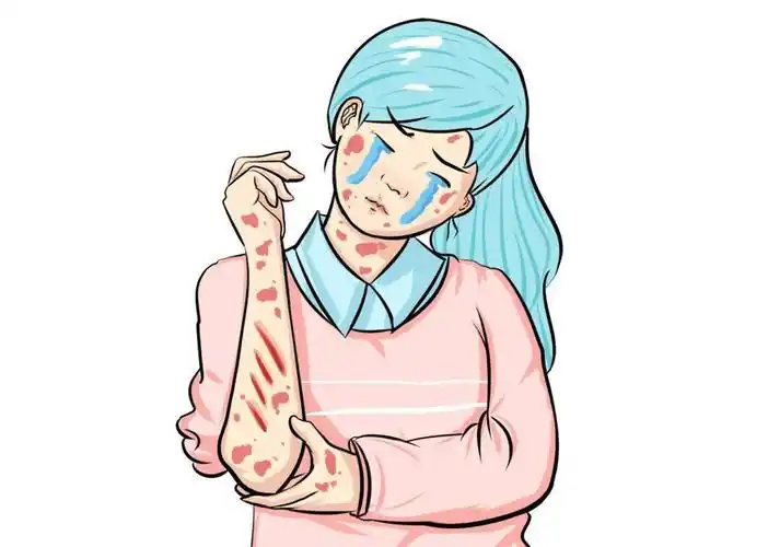 我们知道牛皮癣的发病是复杂的,想要获得良好的治疗效果,就要及时正确