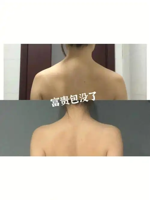 消除斜方肌,富贵包的一周安排97快来练!
