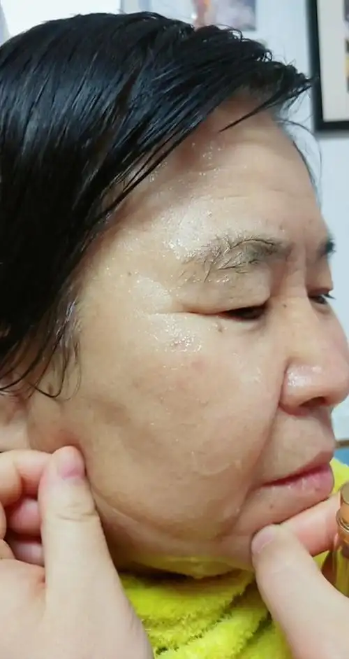 去皱纹#脸部下垂皮肤松弛,皱纹你有吗