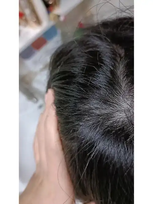 被托尼剪坏的头发