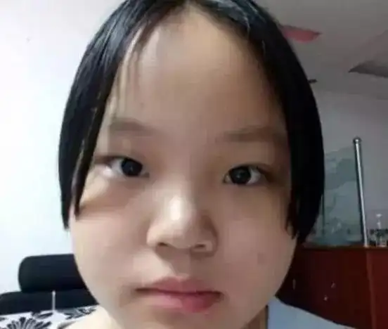 除此之外,你还觉得哪些脸型很难看呢?欢迎留言讨论.