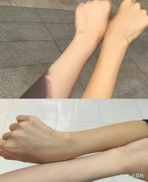 皮肤黑怎么变白?