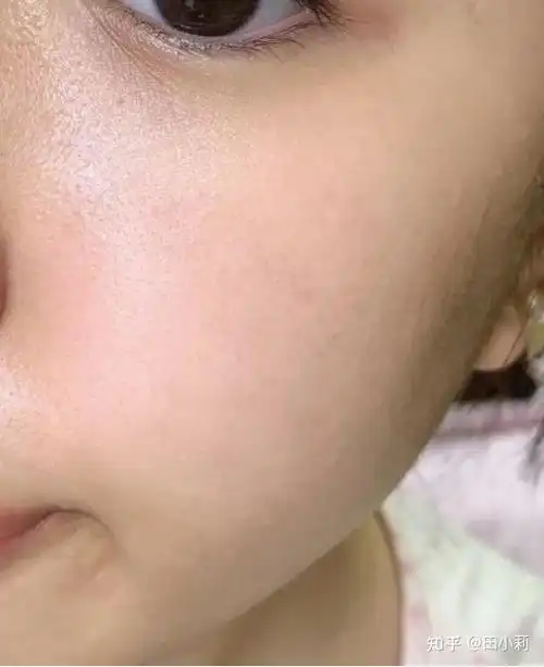 怎么收缩毛孔 - 知乎