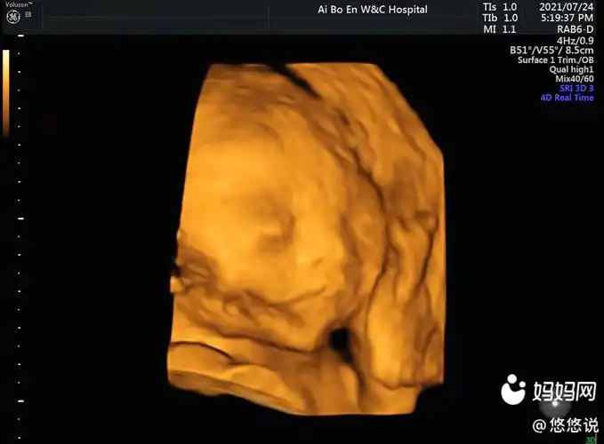 24周四维照,医生说我宝宝头偏大了点,有谁懂这个数据啊?