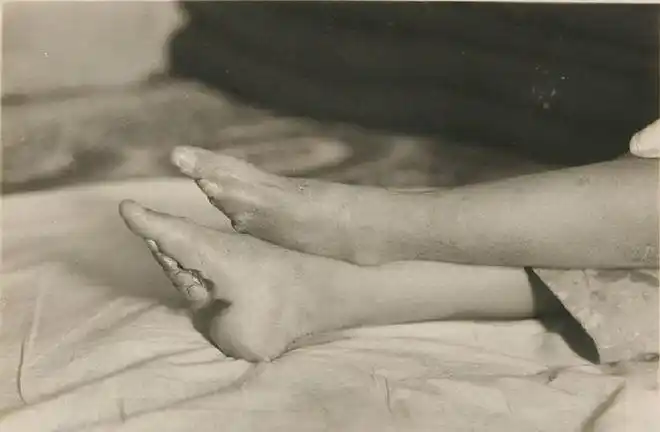 古人审美有多可怕女性要缠三寸金莲脚越小求亲的越多