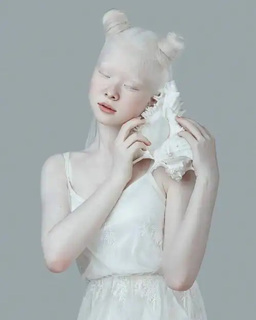 白化病姐妹罕见美照曝光引6万粉丝赞叹看一眼就忘不掉