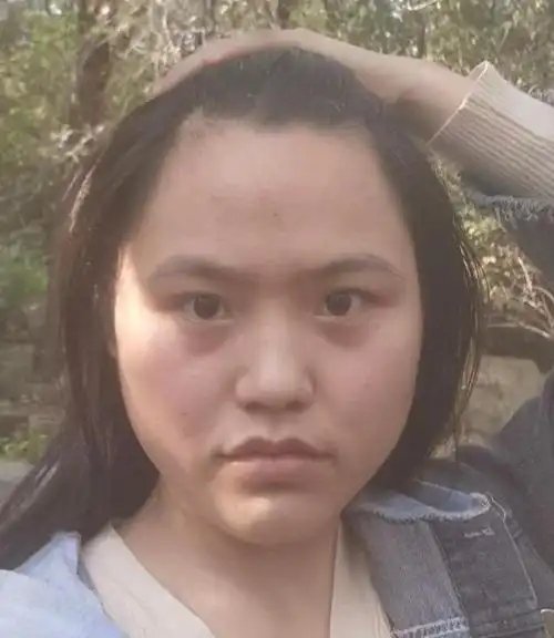 被说长相丑的女生,大多是这几种脸型!倭瓜脸很少见,希望你没有