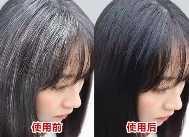 白转黑是真的吗怎么做可以让白发变黑呢