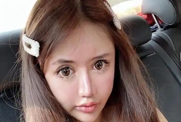 网红脸女孩娜娜曾3年内整容60余次把自己整成了芭比娃娃