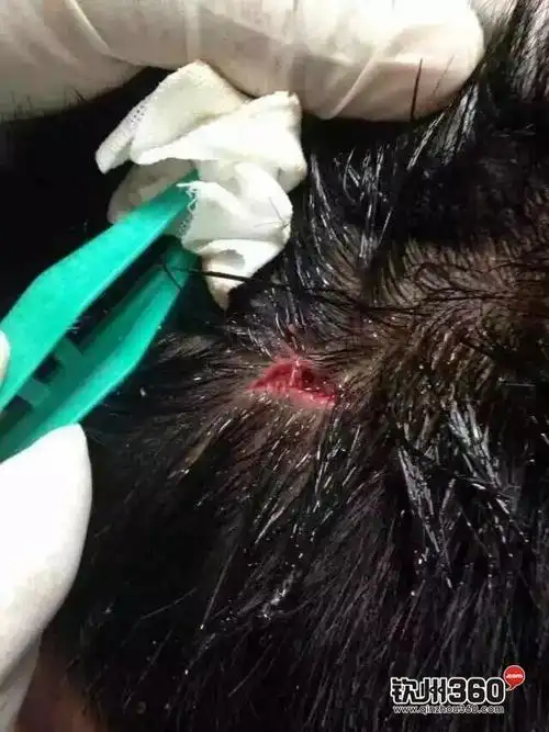 511号晚11点钦州市年年丰打人事件有图有真相